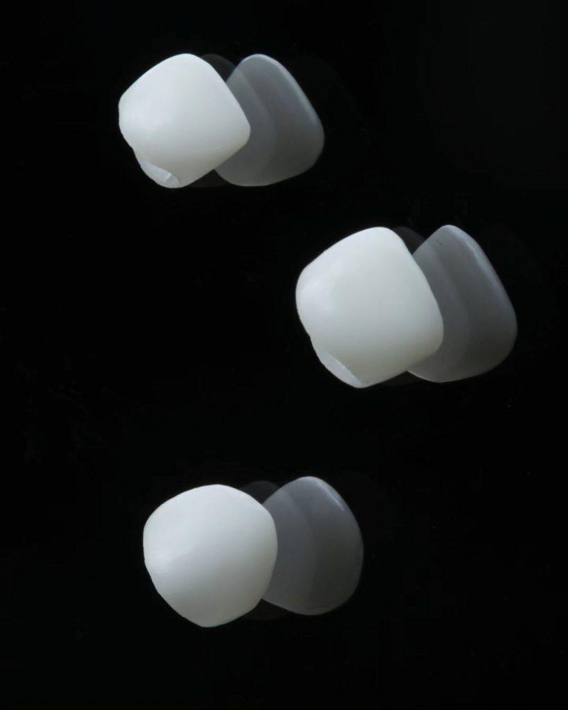 Anterior Pediatrik Kuronlar